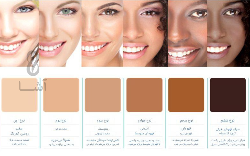 انتخاب رنگ طلا بر اساس تناژ پوستی