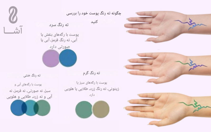 انتخاب رگ طلا متناسب با رگ های بدن